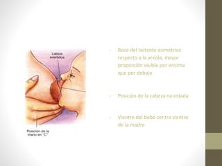 - Boca del lactante asimétrica
respecto a la areola, mayor
proporción visible por encima
que por debajo
- Posición de la cabeza no rotada
- Vientre del bebé contra vientre
de la madre
 
