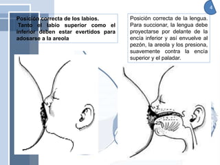 Posición correcta de los labios.
Tanto el labio superior como el
inferior deben estar evertidos para
adosarse a la areola
Posición correcta de la lengua.
Para succionar, la lengua debe
proyectarse por delante de la
encía inferior y así envuelve al
pezón, la areola y los presiona,
suavemente contra la encía
superior y el paladar.
4
 