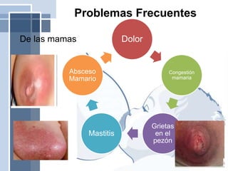 Problemas Frecuentes
De las mamas Dolor
Congestión
mamaria
Grietas
en el
pezón
Mastitis
Absceso
Mamario
 