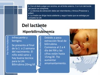 6. Con el dedo pulgar por encima, en el limite externo, 3 a 4 cm del borde
del pezón se comprime.
7. La técnica de extracción debe ser intermitente y rítmica (Presionar y
soltar)
8. La madre se dirige hacia adelante y seguir hasta que se extraiga por
completo la LM.
9. Después de la extracción, se humedecen los pezones con LM y se deja
secar.
Del lactante
Porlechematerna
Infrecuente y
benigno.
Se presenta al final
de la 1 o 2 semana
del nacimiento. El
niño está sano y
hay buena tecnica
para la LM.
Bilirrubina:20mg/dl
Poralimentacióninadecuada
Debido a poca
extracción fecal de
bilirrubina.
Comienza al 2 a 4
día del RN y las
cifras están hasta
15mg/dl. Tto
aumentar
amamantamiento.
Hiperbilirrubinemia
 