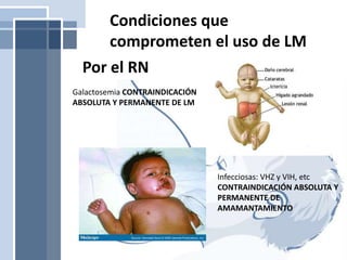Condiciones que
comprometen el uso de LM
Galactosemia CONTRAINDICACIÓN
ABSOLUTA Y PERMANENTE DE LM
Infecciosas: VHZ y VIH, etc
CONTRAINDICACIÓN ABSOLUTA Y
PERMANENTE DE
AMAMANTAMIENTO
Por el RN
 