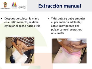 Extracción manual
• Y después se debe empujar
el pecho hacia adelante,
con el movimiento del
pulgar como si se pusiera
una huella
• Después de colocar la mano
en el sitio correcto, se debe
empujar el pecho hacia atrás
 