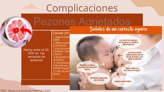 Complicaciones
Pezones Agrietados
Afecta entre el 20-
30% en 1as
semanas de
lactancia
Causas principales
•1.Agarre inadecuado del
bebé
•2.Mala posición durante
la lactancia
•3.Uso de productos
irritantes: Jabones o
cremas
•4.Suciedad o humedad
excesiva:
•5. Condiciones médicas:
Infección por cándida,
frenillo lingual corto.
•6. Uso de extractores de
leche
Manifestaciones
clínicas
•Dolor: Intenso,
especialmente al inicio
de la succión.
•Fisuras o grietas
visibles: Que pueden
sangrar o infectarse.
•Enrojecimiento o
inflamación: Alrededor
del pezón.
•Ardor persistente:
Asociado a infecciones
secundarias.
Tratamiento
•1.Corrección del agarre
y posición
•2.Cuidados del pezón:
Aplicar leche materna.
•3.Uso de lanolina pura:
Hidratante que
promueve la
cicatrización y reduce la
irritación.
•4.Tratamiento de
infecciones
secundarias: Miconazol
o nistatina, mupirocina
•5.Descanso temporal
del pezón
OMS, "Apoyo a la lactancia materna", 2023.
 