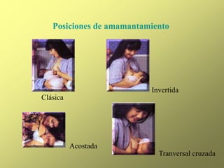 Posiciones de amamantamiento
Clásica
Invertida
Acostada
Tranversal cruzada
 