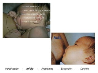 Introducción   -   Inicio   -   Problemas   -   Extracción   -   Destete
 