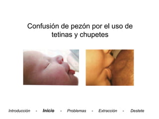 Confusión de pezón por el uso de
                 tetinas y chupetes




Introducción   -   Inicio   -   Problemas   -   Extracción   -   Destete
 