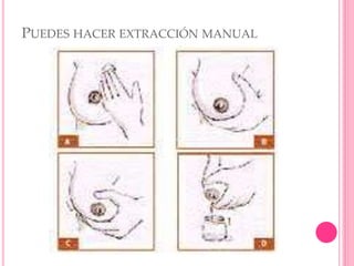 PUEDES HACER EXTRACCIÓN MANUAL
 