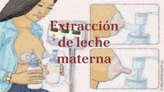 Extracción
de leche
materna
 