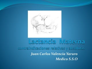 Juan Carlos Valencia Yaruro
Medico S.S.O
 