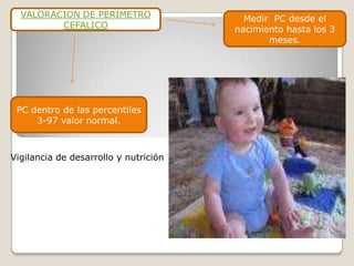 VALORACION DE PERIMETRO                Medir PC desde el
         CEFALICO                      nacimiento hasta los 3
                                              meses.




 PC dentro de las percentiles
     3-97 valor normal.



Vigilancia de desarrollo y nutrición
 