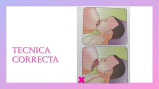 TECNICA
CORRECTA
 