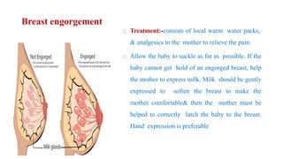 Breast engorgement
 Treatment:-consists of local warm water packs,
& analgesics to the mother to relieve the pain.
 Allow the baby to suckle as far as possible. If the
baby cannot get hold of an engorged breast, help
the mother to express milk. Milk should be gently
expressed to soften the breast to make the
mother comfortable& then the mother must be
helped to correctly latch the baby to the breast.
Hand expression is preferable
 