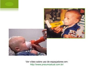 Ver vídeo sobre uso de espaçadores em: http://www.pneumoatual.com.br/ 