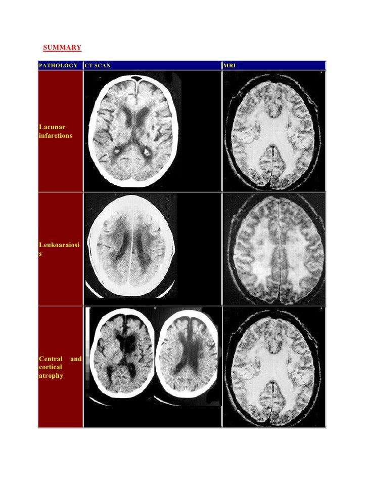 Radiological pathology of microvascular brain disease
