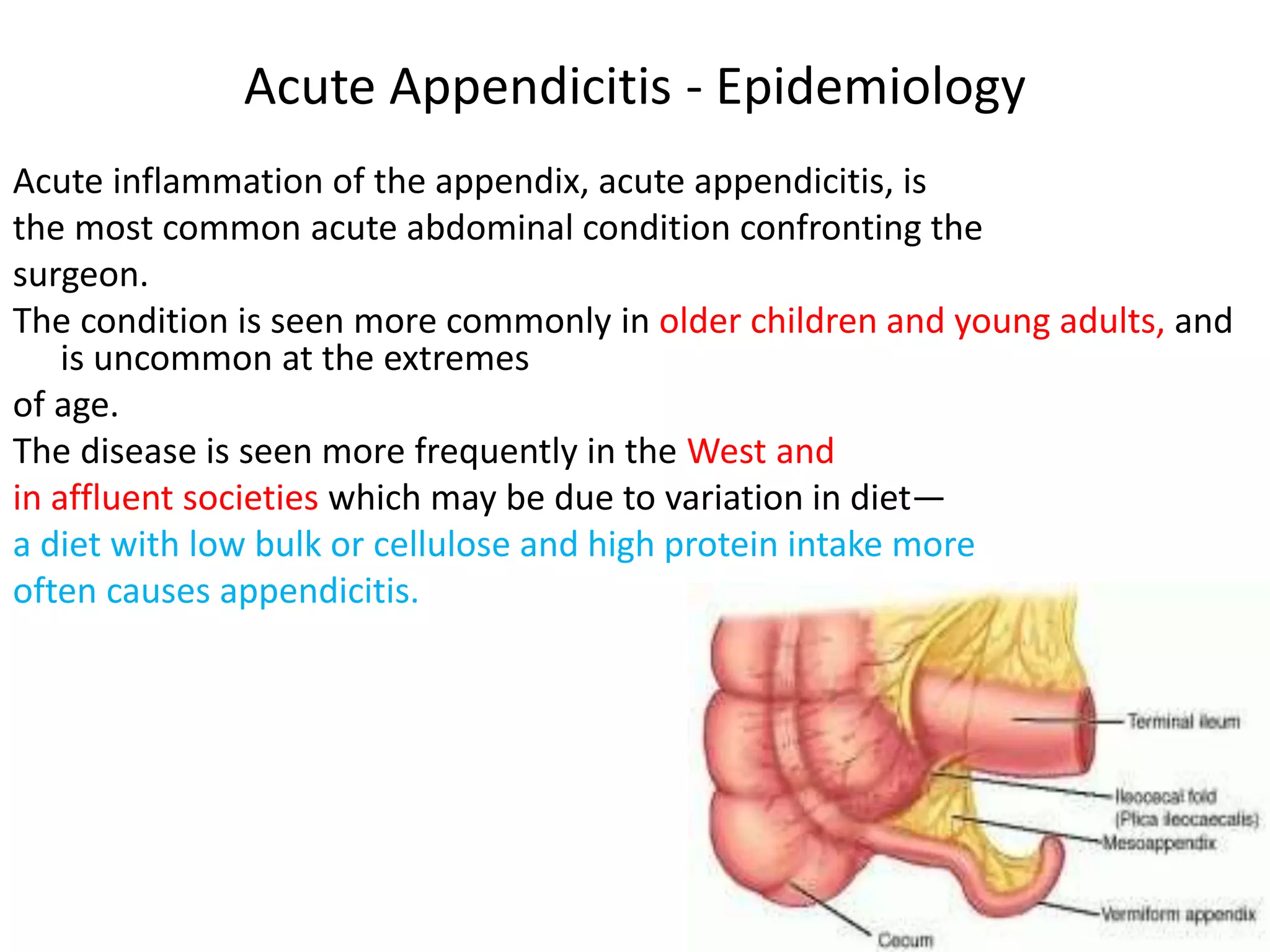 L acute appendicitis | PPTX
