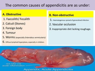 The common causes of appendicitis are as under:
A. Obstructive
1. Faecolith/ Fecalith
2. Calculi (Stones)
3. Foreign body
4. Tumour
5. Worms (especially Enterobius vermicularis)
6. Diffuse lymphoid hyperplasia, especially in children.
B. Non-obstructive
1. Haematogenous spread of generalised infection
2. Vascular occlusion
3. Inappropriate diet lacking roughage.
 