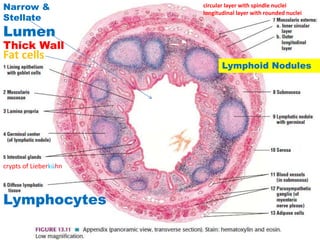 L acute appendicitis | PPTX