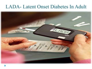LADA- Latent Onset Diabetes In Adult 
 