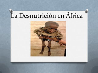 La Desnutrición en África
 