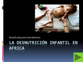 La desnutrición infantil en africa Rodolfo Alejandro Poot Martínez 