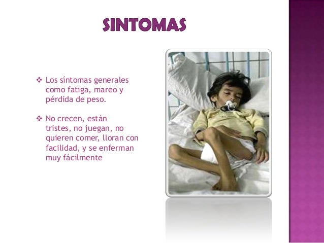 La desnutricion - Cuadro clinico - sintomas y causas La desnutricion - Cuadro clinico - sintomas y causas