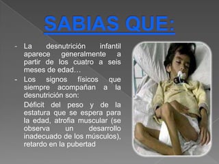 - La     desnutrición    infantil
  aparece     generalmente     a
  partir de los cuatro a seis
  meses de edad…
- Los signos físicos que
  siempre acompañan a la
  desnutrición son:
  Déficit del peso y de la
  estatura que se espera para
  la edad, atrofia muscular (se
  observa      un     desarrollo
  inadecuado de los músculos),
  retardo en la pubertad
 