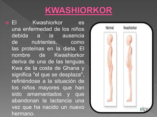    El        Kwashiorkor        es
    una enfermedad de los niños
    debida      a    la   ausencia
    de       nutrientes,     como
    las proteínas en la dieta. El
    nombre       de     Kwashiorkor
    deriva de una de las lenguas
    Kwa de la costa de Ghana y
    significa "el que se desplaza",
    refiriéndose a la situación de
    los niños mayores que han
    sido amamantados y que
    abandonan la lactancia una
    vez que ha nacido un nuevo
    hermano.
 