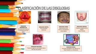 CLASIFICACIÓNDE LAS DISGLOSIAS
DISGLOSIA
MANDIBULAR
Alteración de la forma
o consistencia de los
labios
DISGLOSIA DENTAL
Por anomalías
dentarias
DISGLOSIA LABIAL
Alteraciones de la
forma o consistencia
de los labios
DISGLOSIA LINGUAL
Trastorno orgánico de la
lengua
Como frenillo
DISGLOSIA PALATINA
Trastorno orgánico del paladar óseo y
del velo del paladar
DISGLOSIA NASAL
Procesos patológicos que afectan las
fosas nasales y su resonancia
 