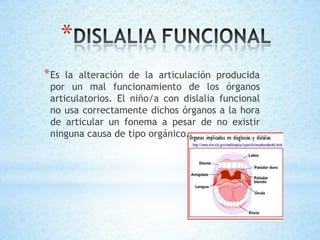 *
*Es la alteración de la articulación producida
por un mal funcionamiento de los órganos
articulatorios. El niño/a con dislalia funcional
no usa correctamente dichos órganos a la hora
de articular un fonema a pesar de no existir
ninguna causa de tipo orgánico.
 