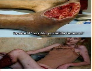 La drogadiccion -Bachillerato Juan de Palafox y Mendoza -Ruben Cielos Tiempos Esbehidy Ramirez