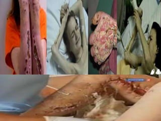 La drogadiccion -Bachillerato Juan de Palafox y Mendoza -Ruben Cielos Tiempos Esbehidy Ramirez