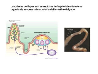 Las placas de Peyer son estructuras linfoepiteliales donde se organiza la respuesta inmunitaria del intestino delgado  