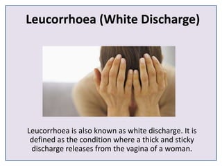 Leucorrhoea (White Discharge)
Leucorrhoea is also known as white discharge. It is
defined as the condition where a thick and sticky
discharge releases from the vagina of a woman.
 