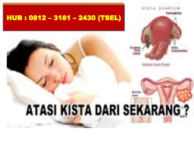 Keluhan Ibu Hamil 3 Bulan Bidanku Com