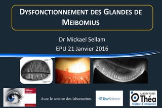DYSFONCTIONNEMENT DES GLANDES DE
MEIBOMIUS
Dr Mickael Sellam
EPU 21 Janvier 2016
Avec le soutien des laboratoires
 