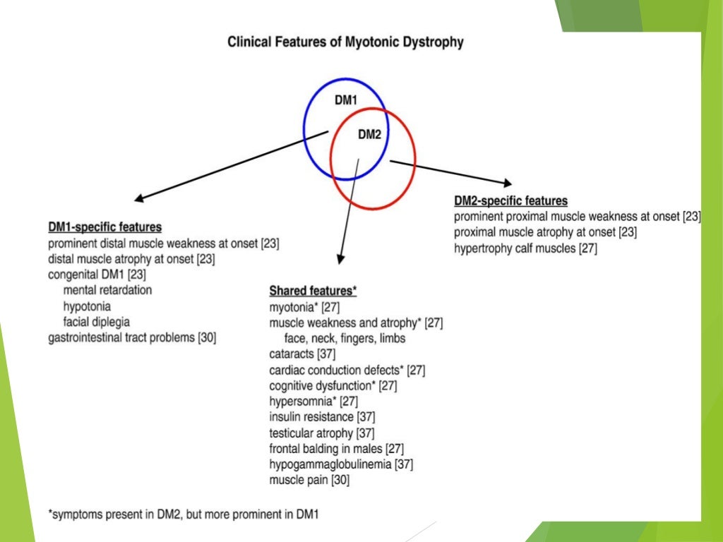 La dystrophie myotonique de type II