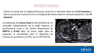 Si bien es cierto que la longitud del hueso nasal no es relevante entre las 11-14 semanas y
sólo su presencia o ausencia lo es, la longitud del hueso nasal es relevante posterior a las 14
semanas.
La evaluación del hueso nasal ha demostrado ser un
marcador independiente de la edad materna, la
translucencia nucal y los niveles bioquímicos de
PAPP-A y ß-hCG libre. Al sumar todas ellas en
conjunto, la sensibilidad para la detección de
trisomia 21 aumenta a un 97%, con un PFP del 5%.
 