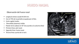 Observación del hueso nasal
 Longitud cráneo-caudal 45-84 mm.
 Con el 75% de la pantalla ocupada por el feto.
 Corte sagital medio:
o Diencéfalo (talamos) visible
o Flexión de la cabeza en 45° de acuerdo a la columna fetal
 Primera línea: piel nasal.
 Segunda línea: hueso nasal.
 Tercera línea: punta de la nariz
 