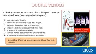 El ductus venoso se realizará sólo si NT>p95. Tiene un
valor de refuerzo (alto riesgo de cardiopatía)
 Corte para-sagital derecho.
 Tamaño del feto ocupando el 75% de la imagen.
 Con ayuda del Doppler color se localiza el DV.
 Colocación de la muestra ocupando todo el vaso.
 En ausencia de movimientos fetales.
 Al menos 3 ondas de buena calidad y mismo tamaño.
 Se repite el procedimiento al menos en 3 ocasiones
Se considera DV anormal la ausencia o reversión del flujo en la
fase atrial.
 