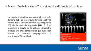 Evaluación de la válvula Tricuspidea :Insuficiencia tricuspidea
La válvula tricúspidea comunica el ventrículo
derecho (VD) de la aurícula derecha (AD) y la
válvula mitral comunica el ventrículo izquierdo
(VI) de la aurícula izquierda (AI). El flujo
sanguíneo a través de la válvula tricuspidea
produce una onda característica que puede ser
normal o anormal (regurgitación o
Insuficiencia Tricuspidea)
 