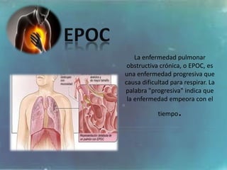 La enfermedad pulmonar
obstructiva crónica, o EPOC, es
una enfermedad progresiva que
causa dificultad para respirar. La
palabra "progresiva" indica que
la enfermedad empeora con el
tiempo.
 