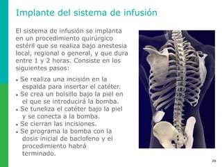 Costo De Bomba De Baclofeno