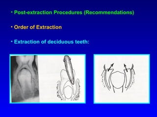 Removal of Broken Roots of
Maxillary Molars
• Maxillary molars roots may be removed by
grasping the palatal and the distob...