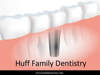 Huff Family Dentistry
www.huffdentistry.com
 