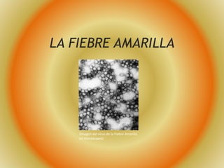 LA FIEBRE AMARILLA 
(Imagen del virus de la Fiebre Amarilla 
en microscopio) 
 