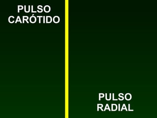 PULSO
CARÓTIDO

PULSO
RADIAL

 