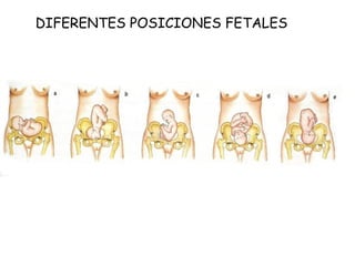 DIFERENTES POSICIONES FETALES
 