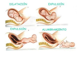 DILATACIÓN EXPULSIÓN
EXPULSIÓN ALUMBRAMIENTO
 
