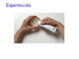 Espermicida
 