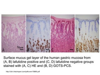 Surface mucus gel layer of the human gastric mucosa from
(A, B) lafutidine positive and (C, D) lafutidine negative groups
stained with (A, C) HE and (B, D) GOTS-PCS.
http://cdn.intechopen.com/pdfs-wm/19866.pdf
 